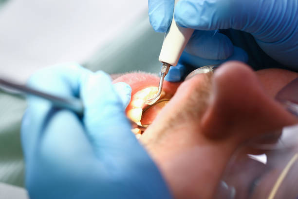 Best Urgent Care for Lost Fillings or Crowns in Aztec, NM